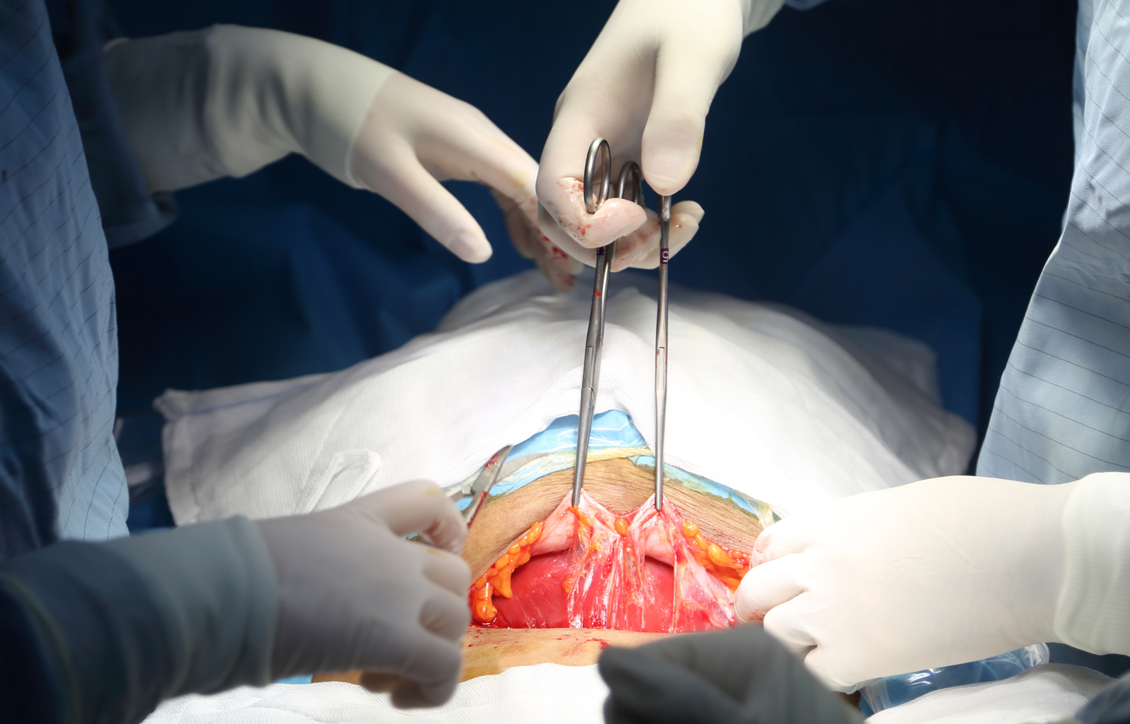 Surgery Anorectal Region