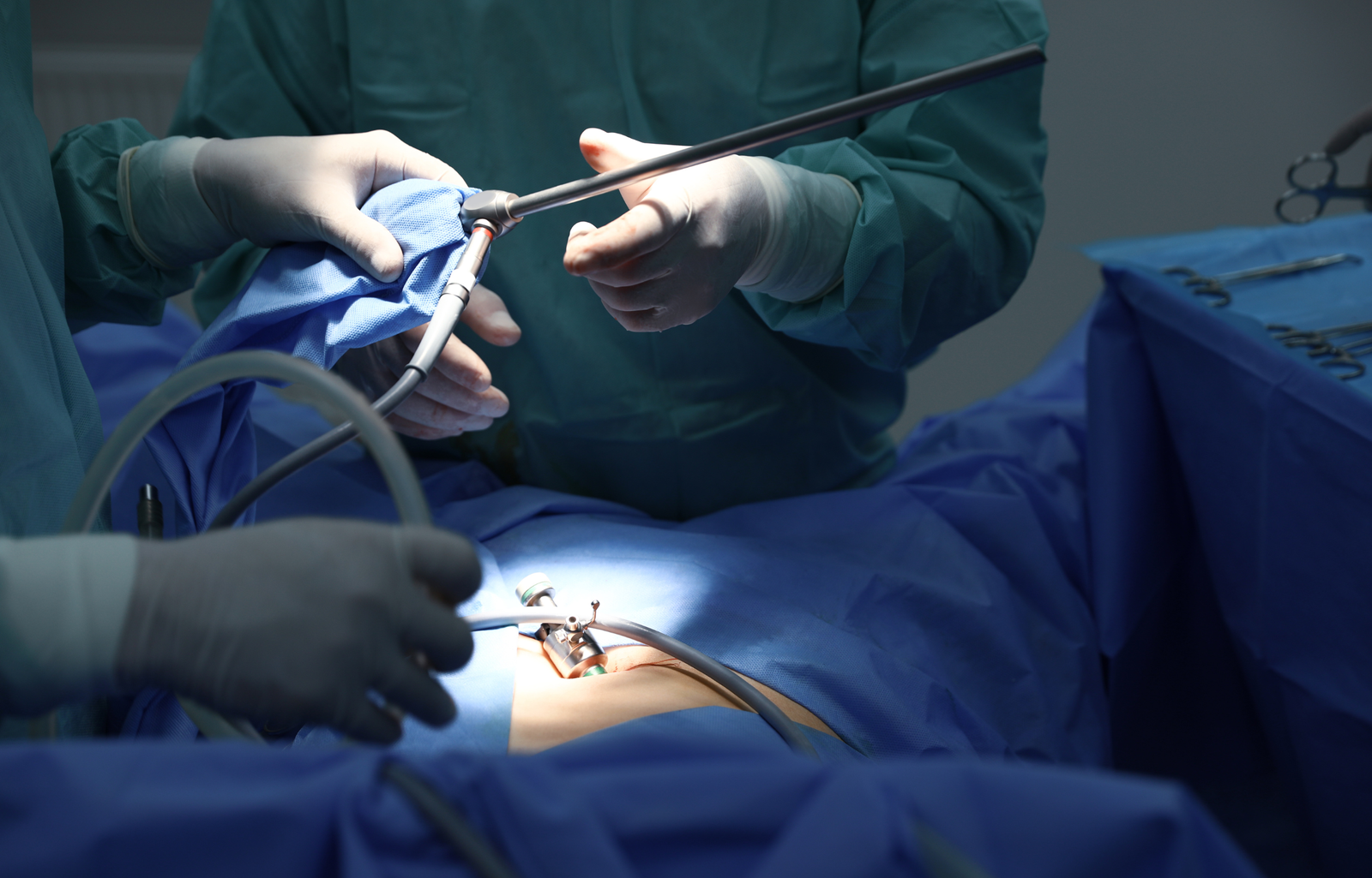 Stomach Surgery
